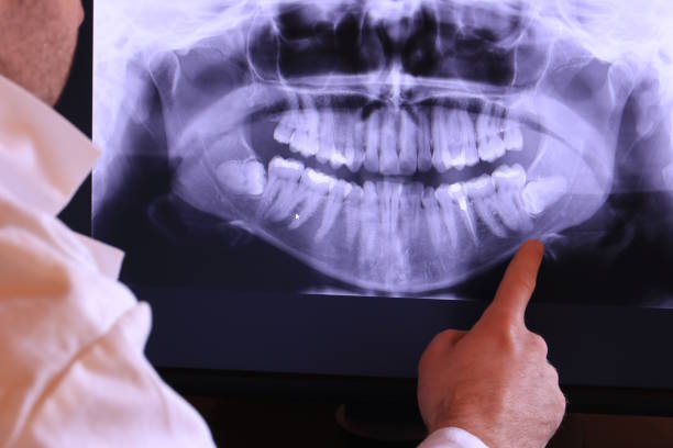 Best Broken or Cracked Tooth Emergency Dentist in Bolivar Peninsula, TX